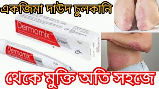 Dermomix Cream এর কাজ কি একজিমা দাউদ চুলকানি থেকে মুক্তি অতি সহজে [upl. by Sommer211]