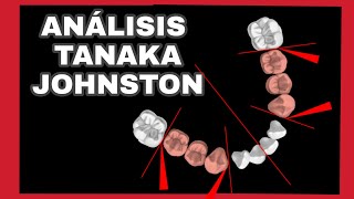 Análisis de Tanaka Johnston  Dentición mixta [upl. by Ilona417]