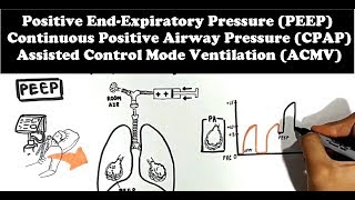 Mechanical Ventilator Lung Mechanics PEEP CPAP ACMV [upl. by Nilrah]