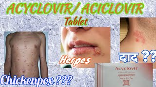 Acyclovir tablets  Herpikind  Herpikind Tablet  Zovirax  Zovirax tablets  uses side effects [upl. by Marjy]