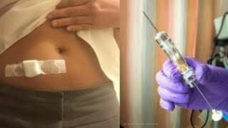 How to Give an Intramuscular Injection [upl. by Jelks]